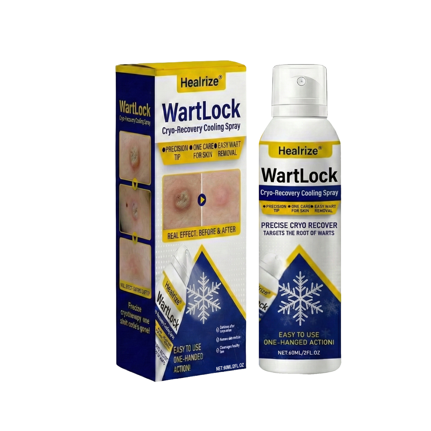 Healrize®❄️WartLock Cryo-Recovery Cooling Spray——Z
