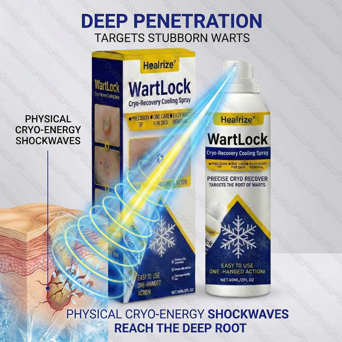 Healrize®❄️WartLock Cryo-Recovery Cooling Spray——Z