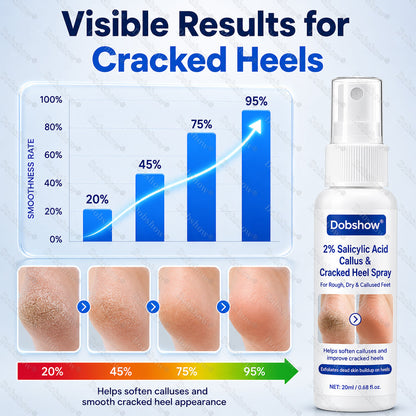 Dobshow® 2% Salicylic Acid Callus & Cracked Heel Spray