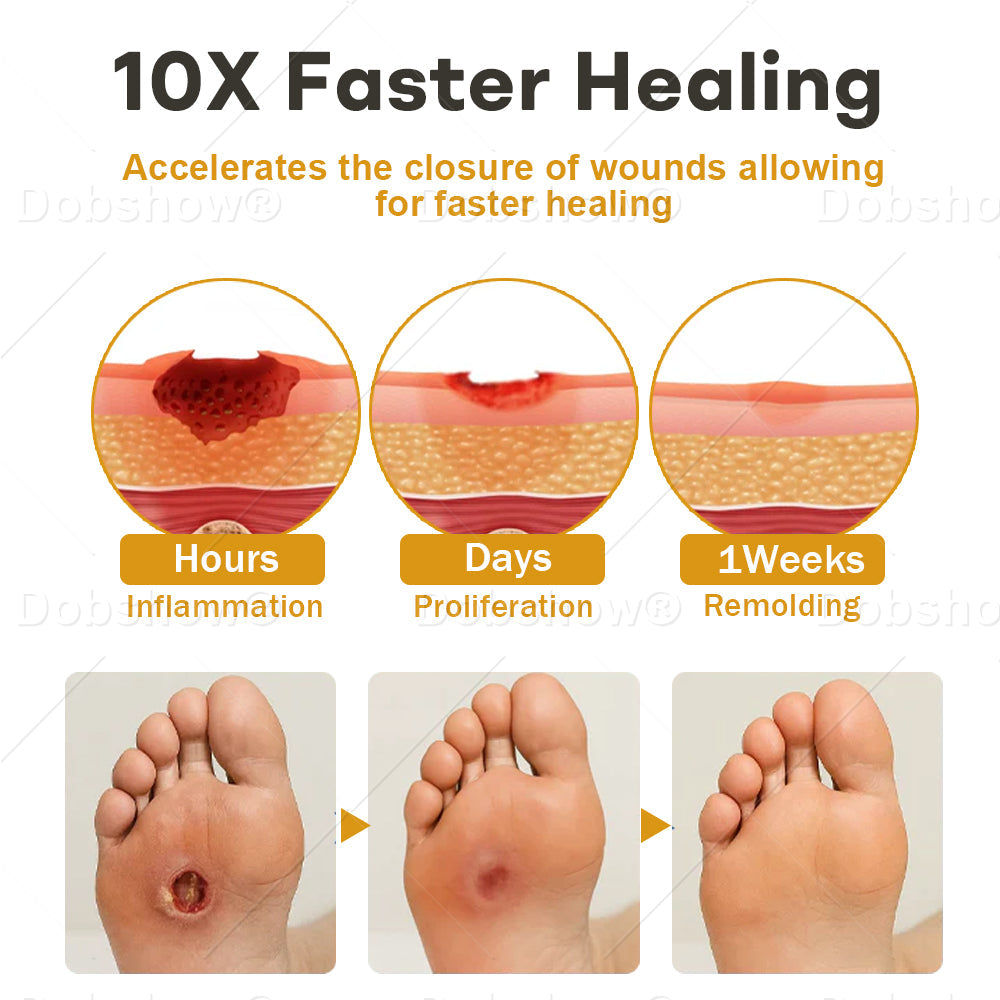 Healrize® 🔥GlucoShield Bee Venom Wound Spray—— Supports Skin Repair & Protects Diabetic Feet