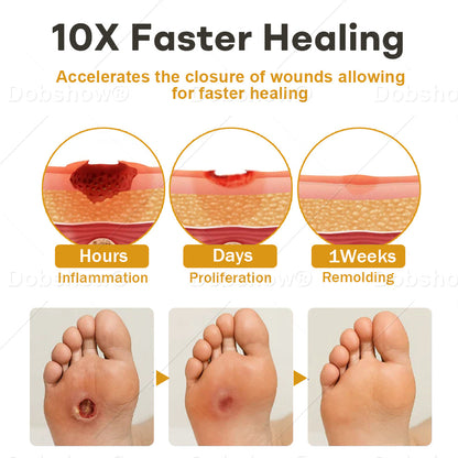 Healrize® 🔥GlucoShield Bee Venom Wound Spray—— Supports Skin Repair & Protects Diabetic Feet