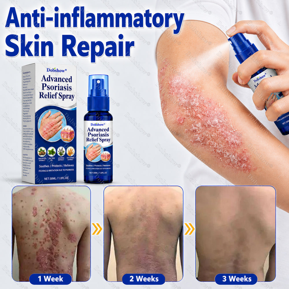 Dobshow® ❄️Advanced Psoriasis Relief Spray