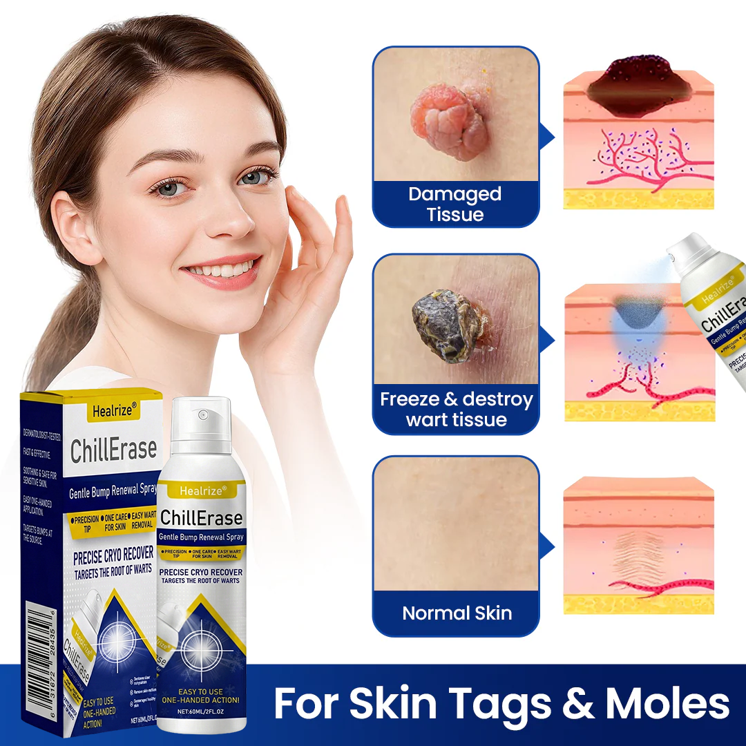 Healrize®ChillErase Gentle Bump Renewal Spray（1）