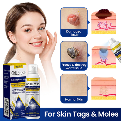 Healrize®ChillErase Gentle Bump Renewal Spray（1）