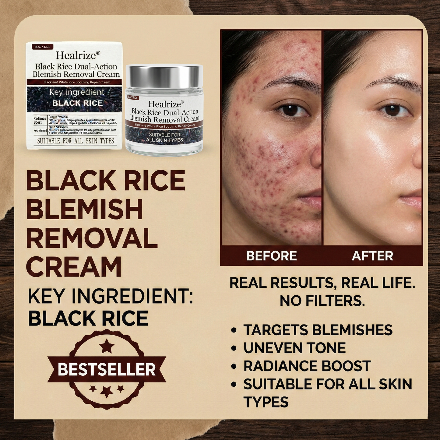 🌿Healrize®Black Rice Dual-Action Blemish Removal Cream
