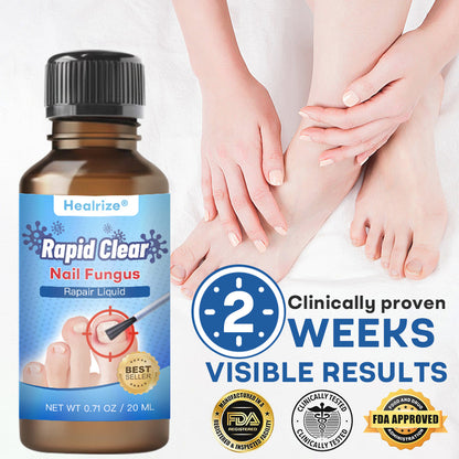 Healrize®Nano Rapid Clear Nail Fungus Rapair Liquid🔥 – Effective in Seven Days, Permanently Eliminates the Root