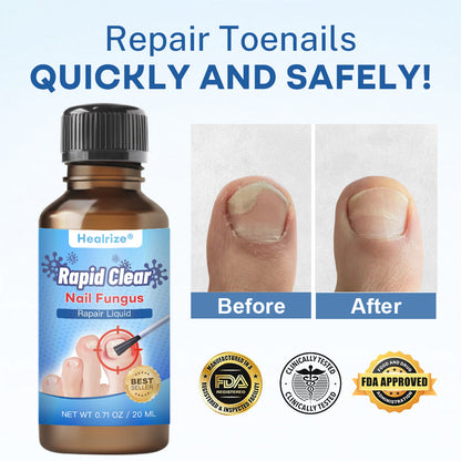 Healrize®Nano Rapid Clear Nail Fungus Rapair Liquid🔥 – Effective in Seven Days, Permanently Eliminates the Root