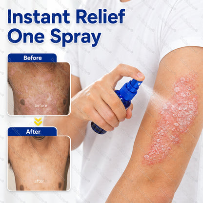Dobshow® ❄️Advanced Psoriasis Relief Spray