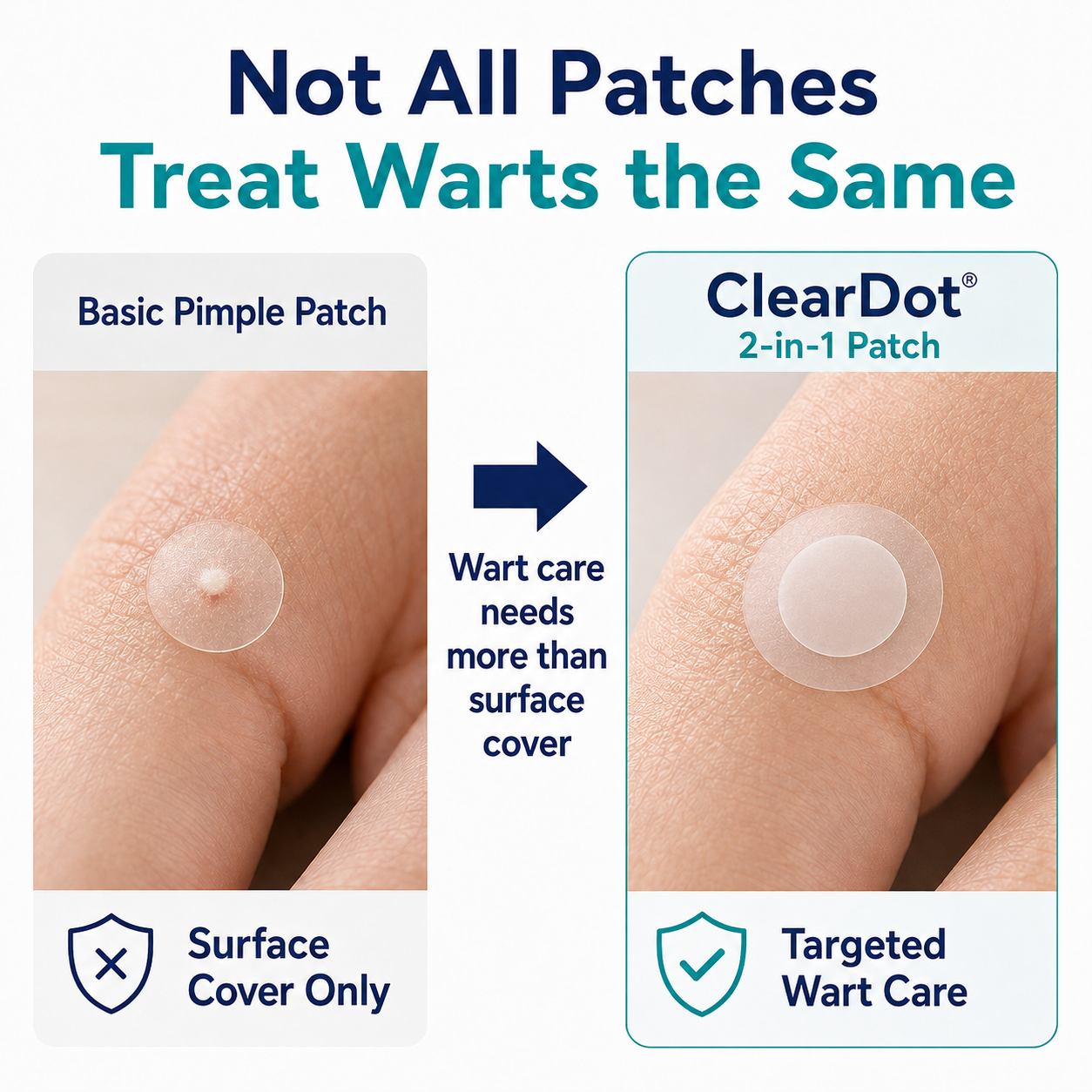 ⚡Dobshow®ClearDot 2-in-1 Patch | Helps Smooth Raised Bumps, Blemishes & Uneven Skin Texture