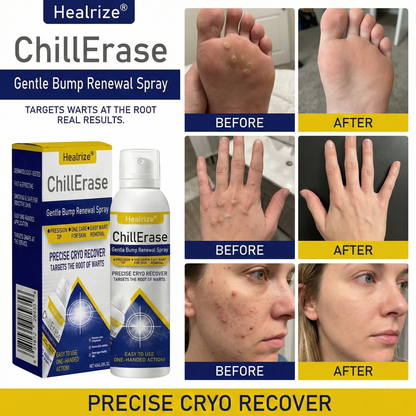 Healrize®ChillErase Gentle Bump Renewal Spray（1）