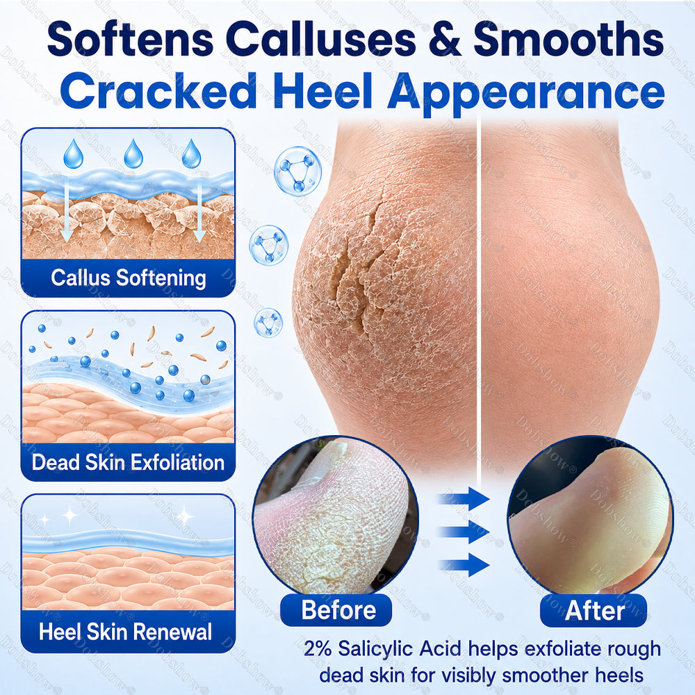 Dobshow® 2% Salicylic Acid Callus & Cracked Heel Spray