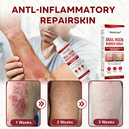 🔥 Healrize®🐌 Snail Mucin Barrier Spray for Flare-Up Relief & Skin Repair