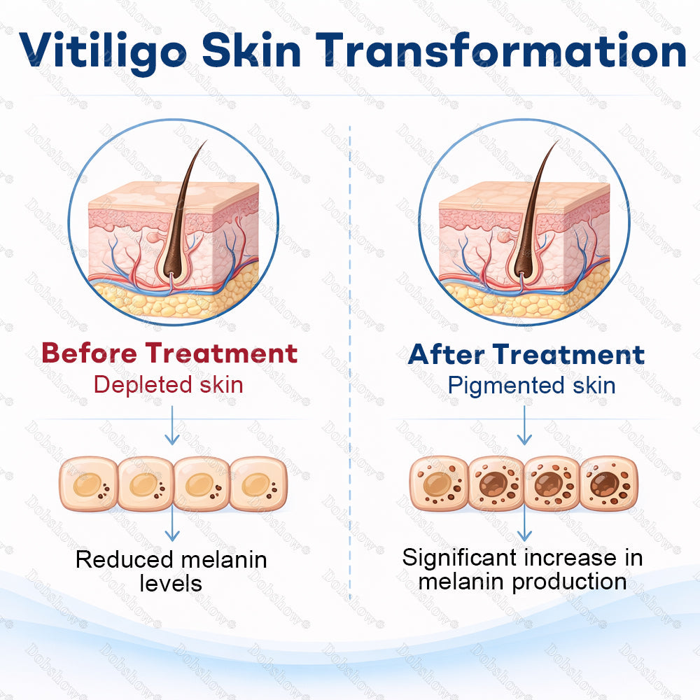 🔥Healrize® Piperine Vitiligo Repigmentation Spray - 👨‍⚕️🌿Steroid-Free Botanical Formula | Gentle & Effective for All Skin Types
