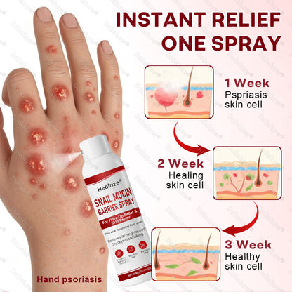 🔥 Healrize®🐌 Snail Mucin Barrier Spray for Flare-Up Relief & Skin Repair