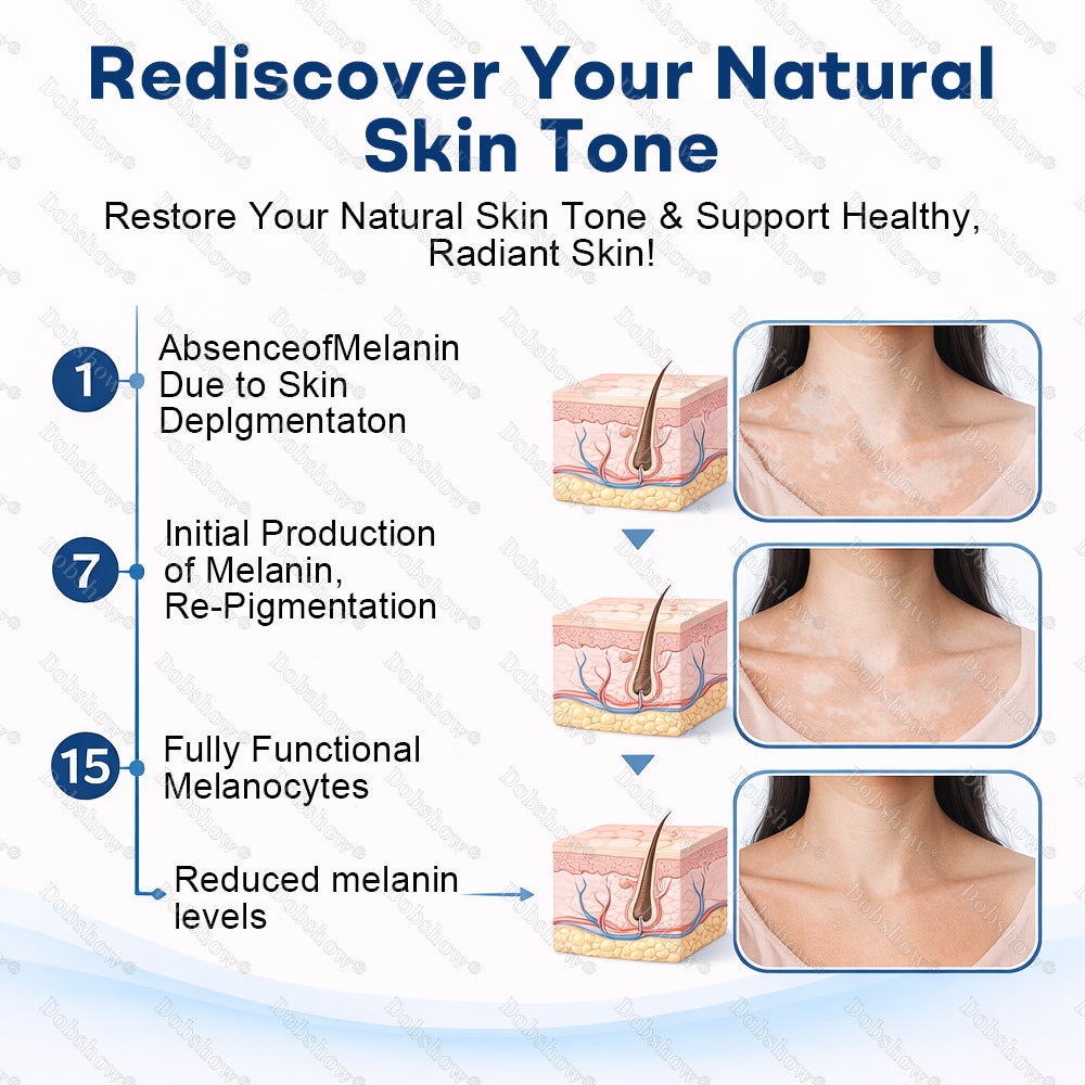 🔥Healrize® Piperine Vitiligo Repigmentation Spray - 👨‍⚕️🌿Steroid-Free Botanical Formula | Gentle & Effective for All Skin Types