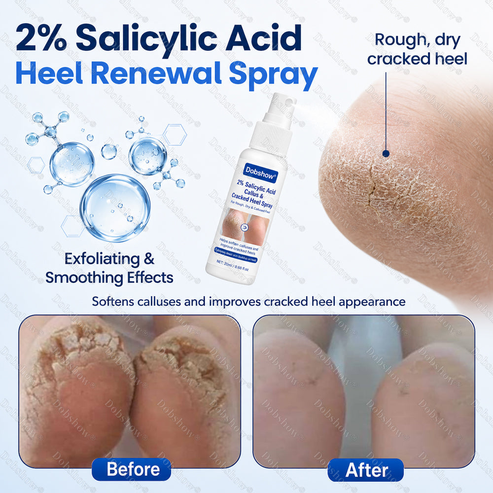 Dobshow® 2% Salicylic Acid Callus & Cracked Heel Spray