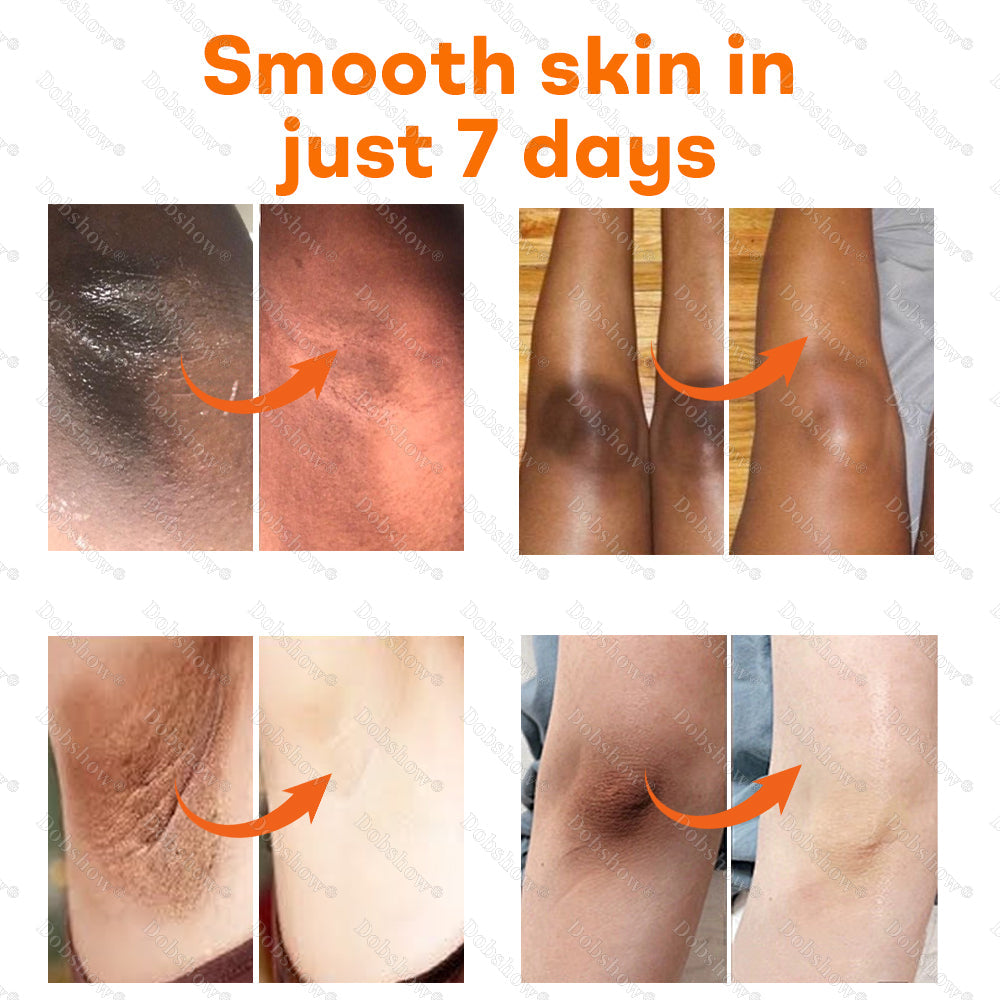 Dobshow®Turmeric Lemon Knees & Elbows Brightening Scrub