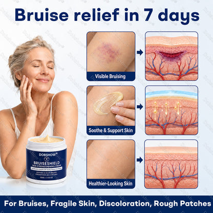 Dobshow® BRUISESHIELD Skin Strengthening Cream ——Z