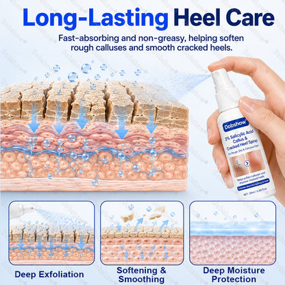 Dobshow® 2% Salicylic Acid Callus & Cracked Heel Spray
