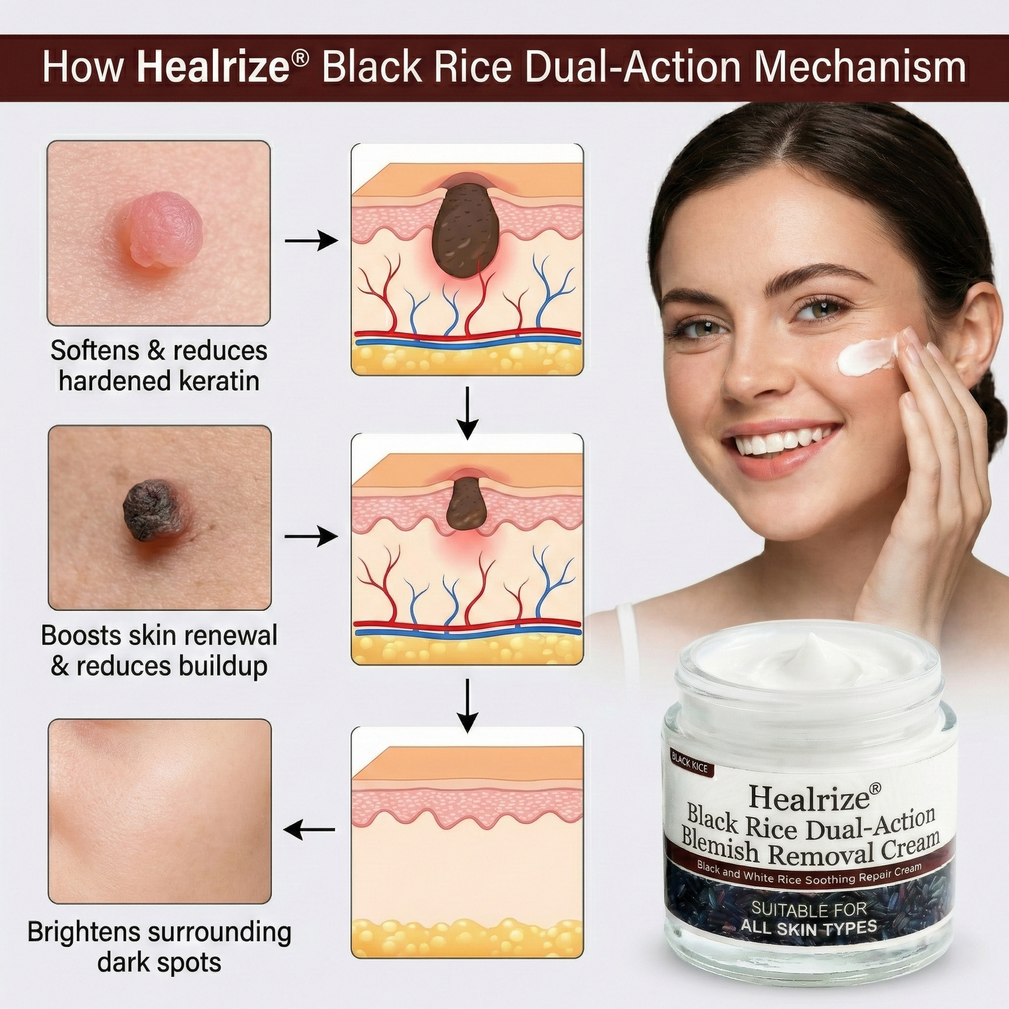 🌿Healrize®Black Rice Dual-Action Blemish Removal Cream