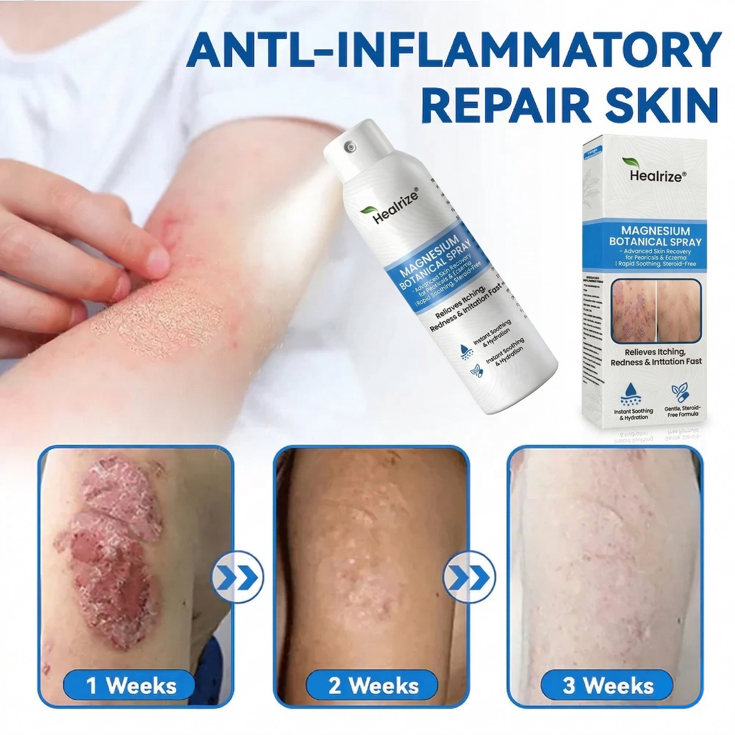 👨‍⚕️Healrize® Magnesium Botanical Spray – 🍃Advanced Skin Recovery for Psoriasis & Eczema | Rapid Soothing, Steroid-Free