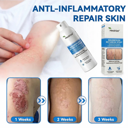 👨‍⚕️Healrize® Magnesium Botanical Spray – 🍃Advanced Skin Recovery for Psoriasis & Eczema | Rapid Soothing, Steroid-Free
