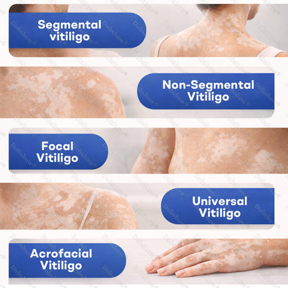 🔥Healrize® Piperine Vitiligo Repigmentation Spray - 👨‍⚕️🌿Steroid-Free Botanical Formula | Gentle & Effective for All Skin Types