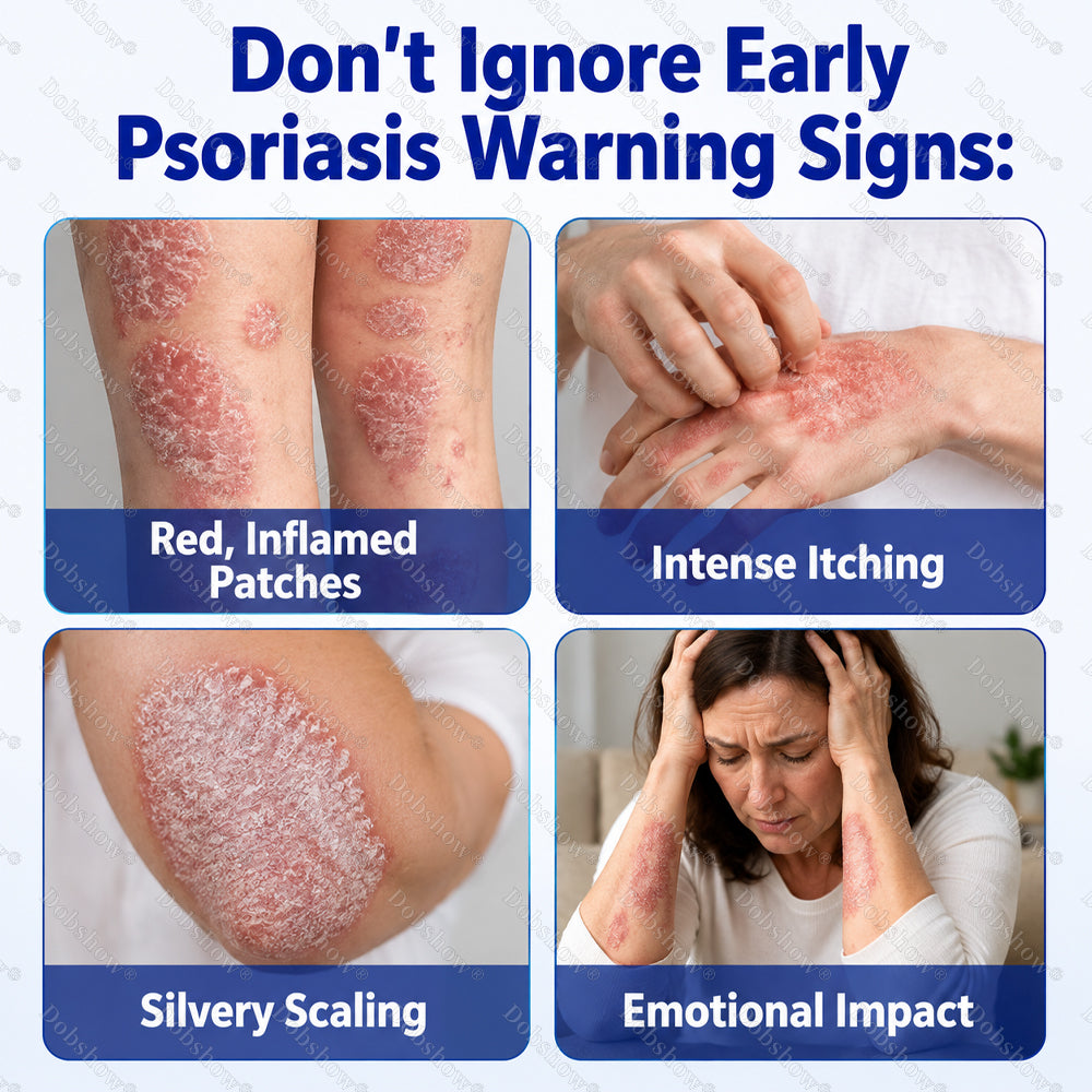 Dobshow® ❄️Advanced Psoriasis Relief Spray