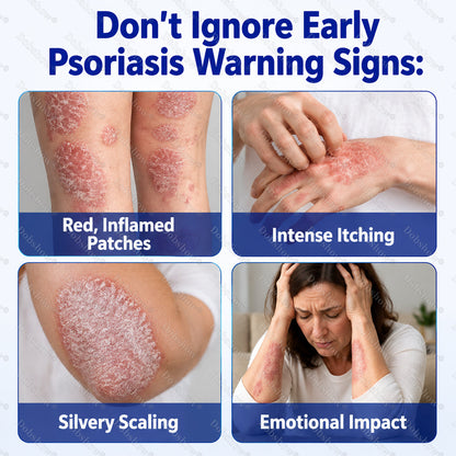 Dobshow® ❄️Advanced Psoriasis Relief Spray
