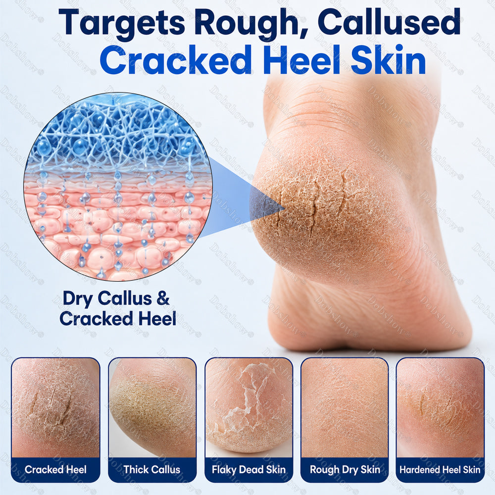 Dobshow® 2% Salicylic Acid Callus & Cracked Heel Spray