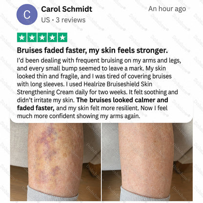Dobshow® BRUISESHIELD Skin Strengthening Cream ——Z