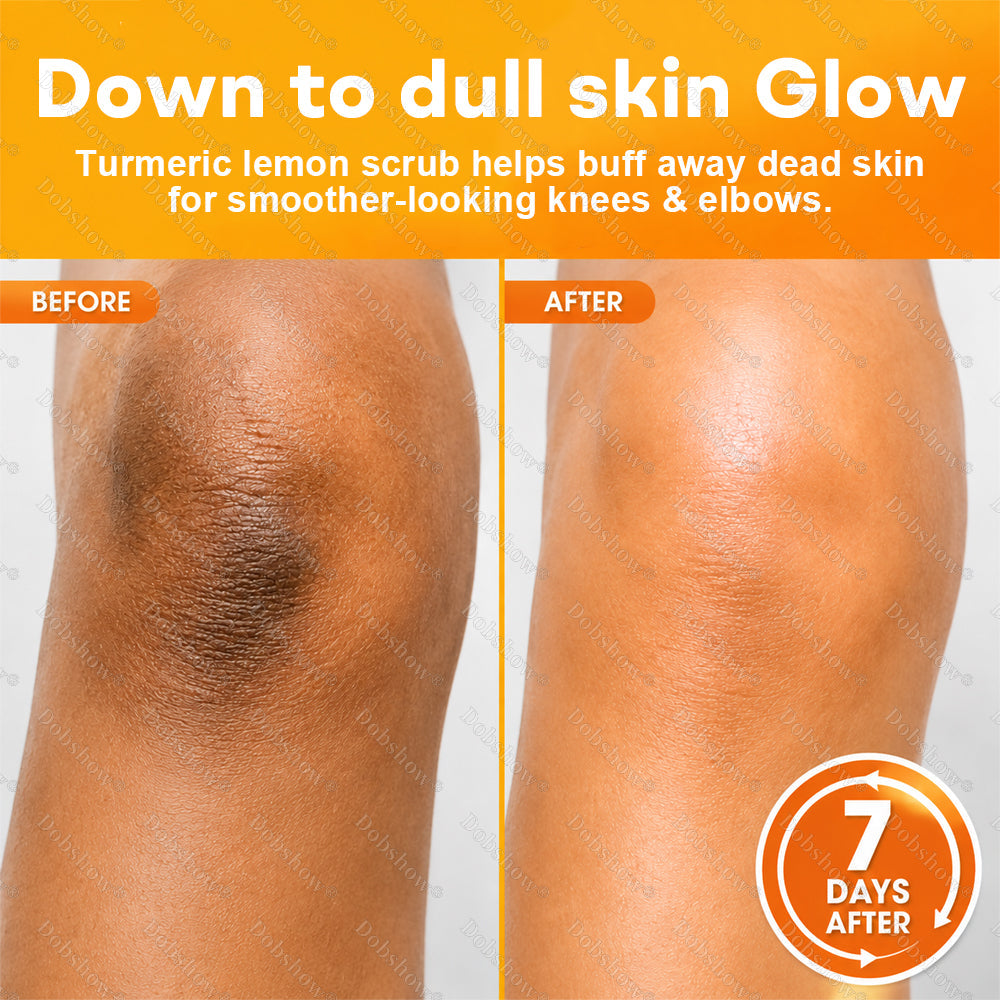 Dobshow®Turmeric Lemon Knees & Elbows Brightening Scrub