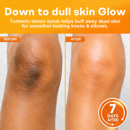 Dobshow®Turmeric Lemon Knees & Elbows Brightening Scrub