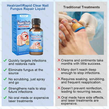 Healrize®Nano Rapid Clear Nail Fungus Rapair Liquid🔥 – Effective in Seven Days, Permanently Eliminates the Root
