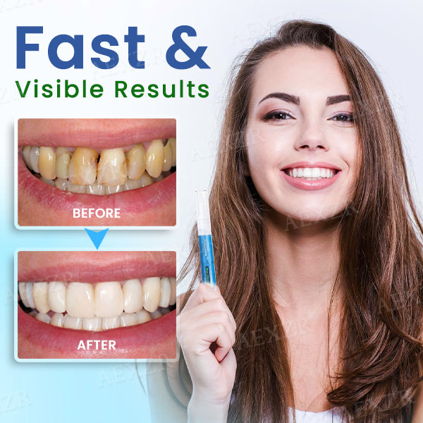 Dobshow®Teeth Whitening Pen