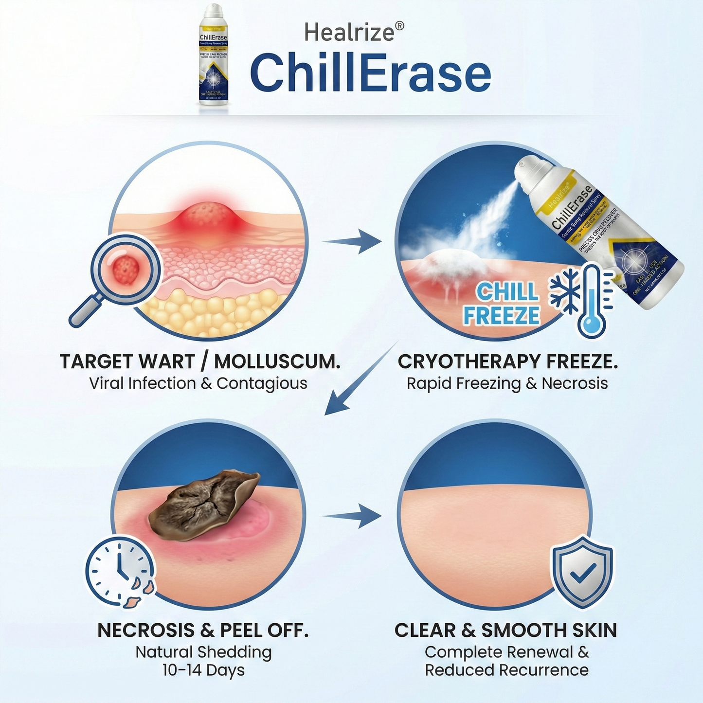 Healrize®ChillErase Gentle Bump Renewal Spray（1）
