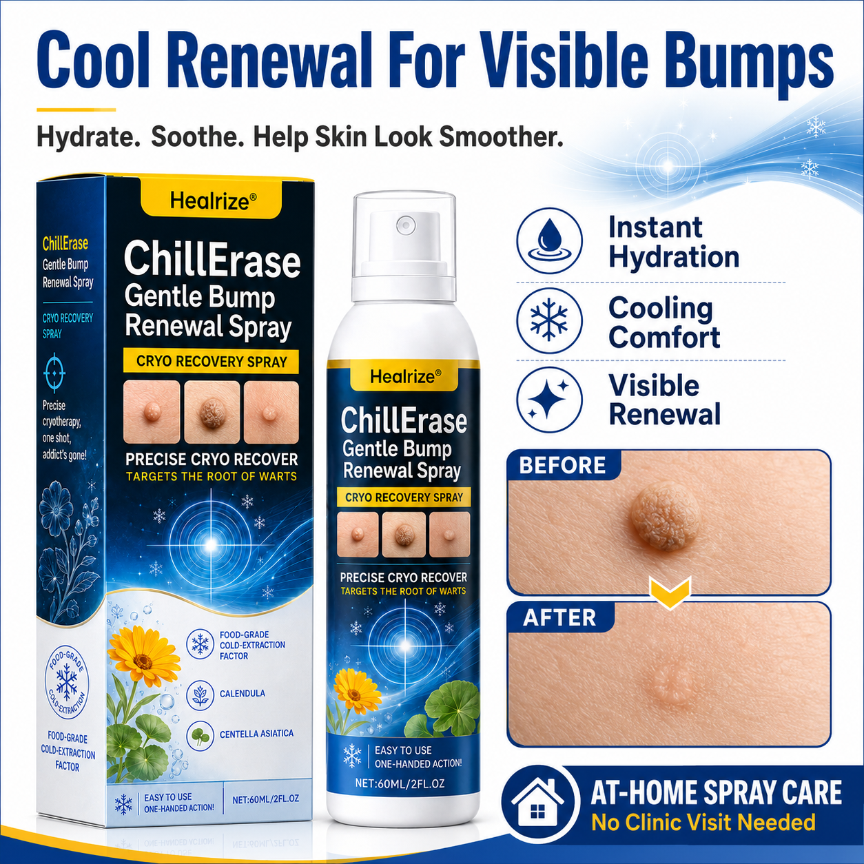 Healrize®❄️ChillErase Gentle Bump Renewal Spray