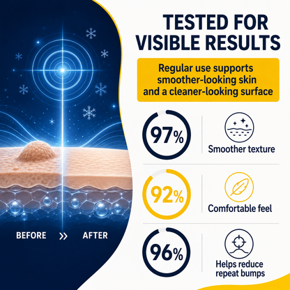 Healrize®❄️ChillErase Gentle Bump Renewal Spray