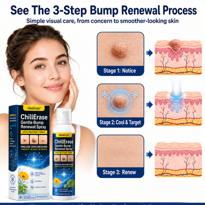 Healrize®❄️ChillErase Gentle Bump Renewal Spray