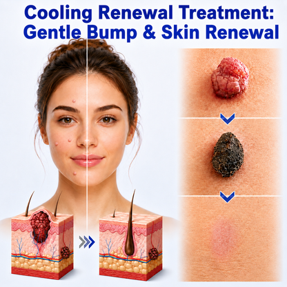 ❄️Healrize®ChillErase Gentle Bump Renewal Spray—Stubborn Skin Bumps & Rough Spots
